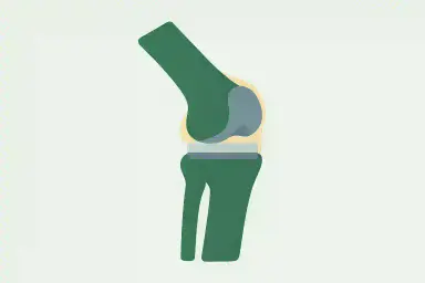 Knee Replacement